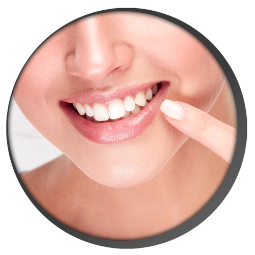 teeth-whitening-melbourne